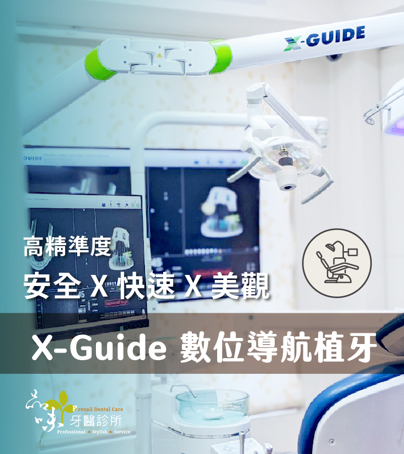 X-Guide  數位導航植牙